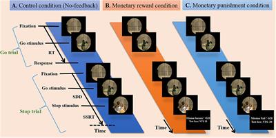 Monetary Reward and Punishment to Response Inhibition Modulate Activation and Synchronization Within the Inhibitory Brain Network